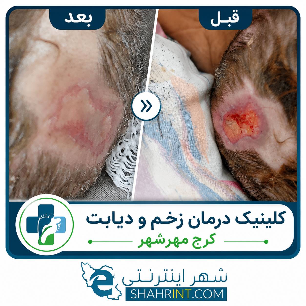 درمانگر زخم مختاری