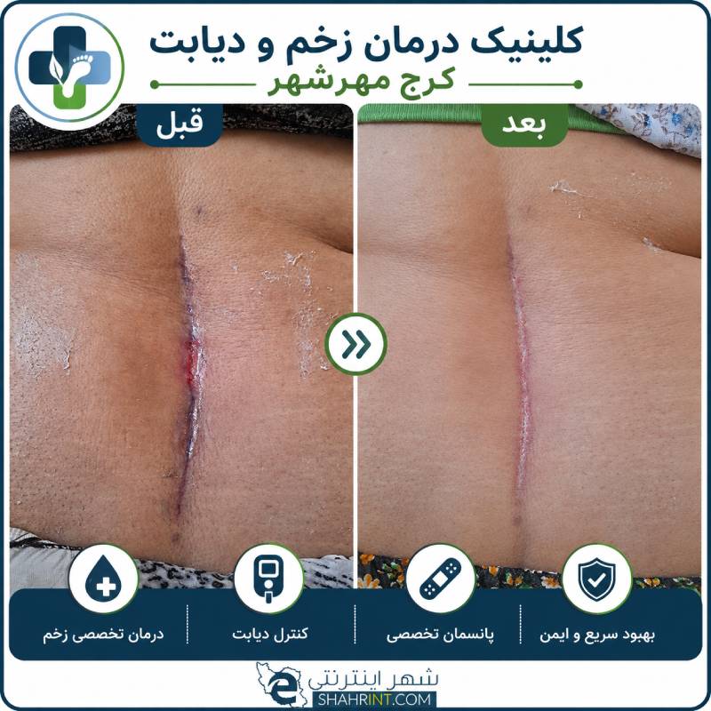 درمانگر زخم مختاری